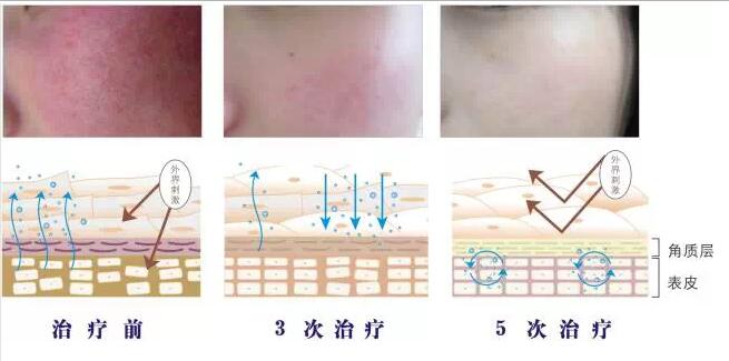 舒敏对比图