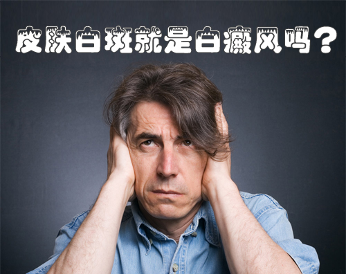 皮肤白斑就是白癜风吗